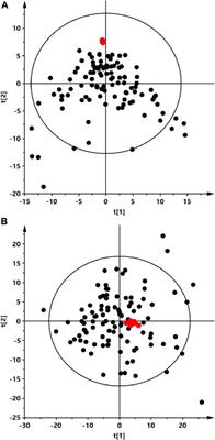 Serum metabolomics identified specific lipid compounds which may serve as markers of disease progression in patients with Alström and Bardet-Biedl syndromes